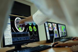 «Медицинская Диагностика-2019»: инновации Philips открывают новые возможности в борьбе с онкологическими заболеваниями