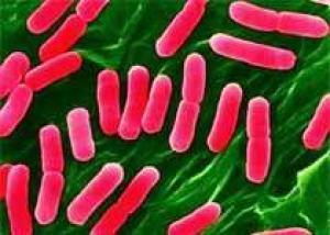 В гамбургерах фирмы из Иллинойса обнаружена E. coli
