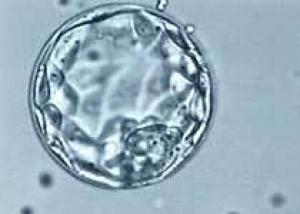 Американцы клонировали эмбрионы человека из клеток кожи