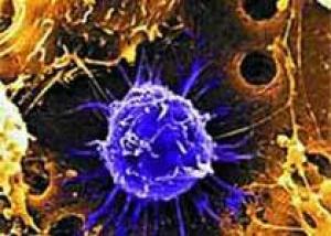 Раковые клетки распространяются посредством образования `пузырьков`