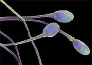 Ученые получили сперму из женских клеток