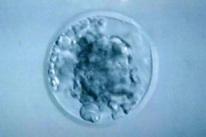 Замороженные эмбрионы подходят для ЭКО лучше свежих
