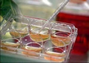 Ученые создают библиотеку стволовых клеток для изучения наследственных заболеваний