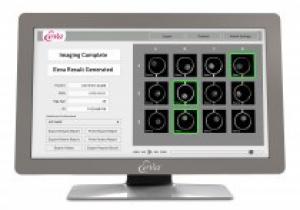 «Мерк Сероно» представил новую тестовую систему Eeva, призванную улучшить результаты экстракорпорального оплодотворения