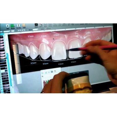 Инновационная DSD-технология по компьютерному моделированию улыбки применяется в медцентре «New Line Dent»