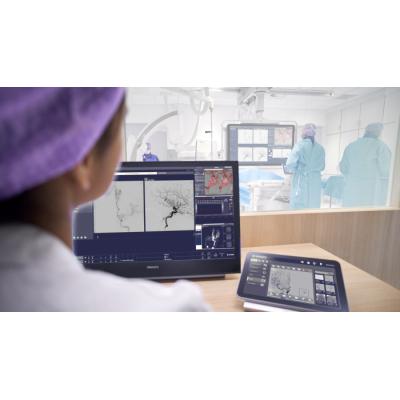 Philips Azurion – надежность и высокие технологии для удобства работы врача и эффективности рентгеноперационной