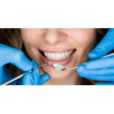 Стоматологический центр «Зууб» приглашает установить зубные импланты Nobel Biocare по акции