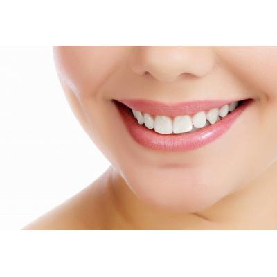 Восстановить зубы с помощью имплантов Nobel Biocare приглашает стоматология «Зууб»