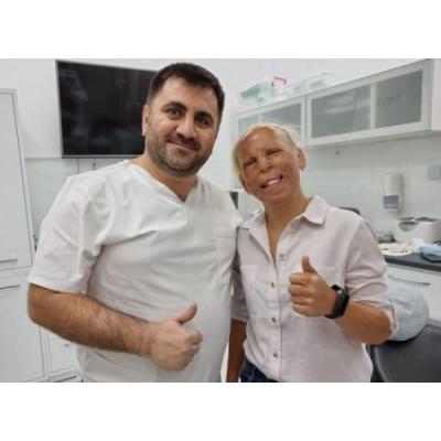 Тотальное протезирование бесплатно девушке с ожогами лица делает стоматолог Вартан Саркисян