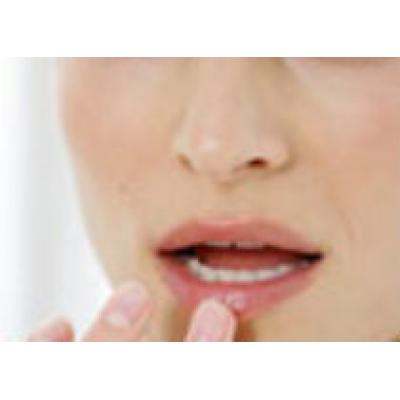 Как избавиться от трещин на губах