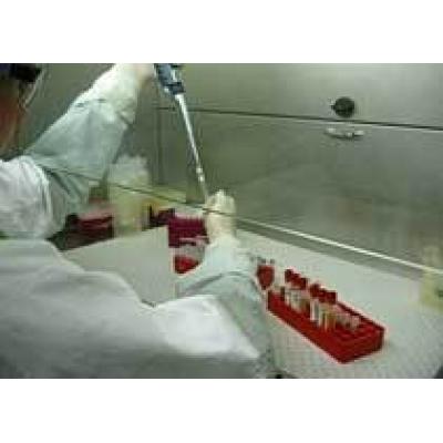 Минздрав обвинили в срыве поставок тест-систем для лечения ВИЧ-инфекции