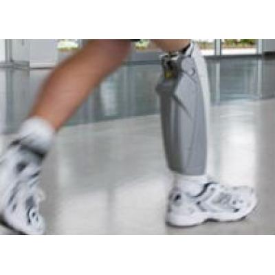 В Лондоне представлен первый бионический коленный протез