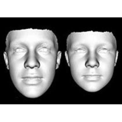 3D-лица расскажут о болезни