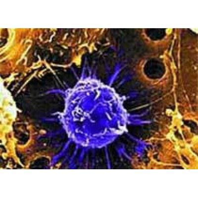 Раковые клетки распространяются посредством образования `пузырьков`