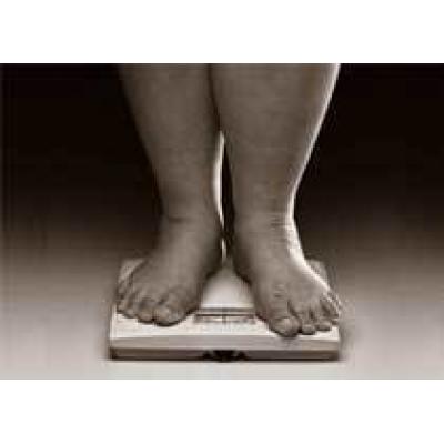 Ожирение увеличивает у женщин риск бесплодия