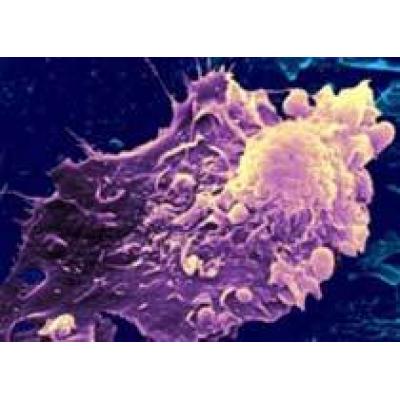 Иммунным клеткам вернут способность атаковать опухоли