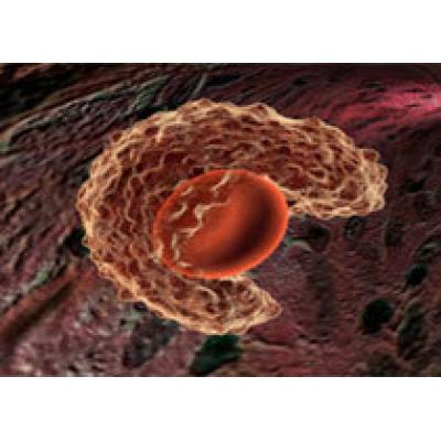 Стволовые клетки помогают лечить последствия инсульта