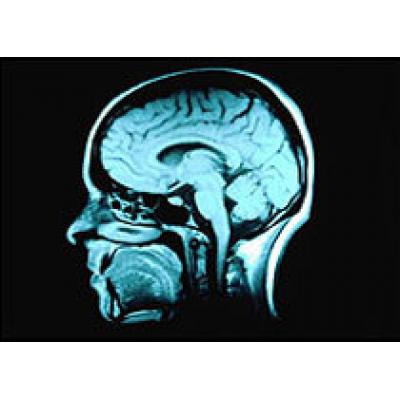 Ученые научились стирать зоны памяти мозга