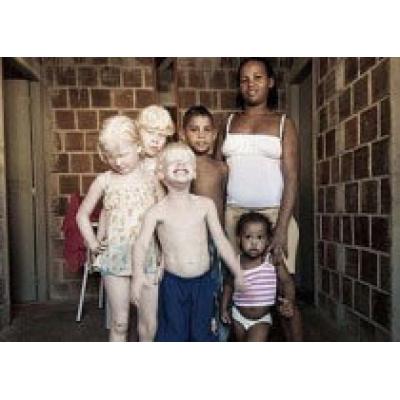 Чернокожая пара произвела на свет троих белых детей