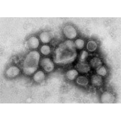 Медики открыли простой способ убивать вирус H1N1