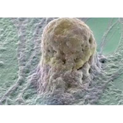 Эксперты: опасайтесь сомнительного лечения стволовыми клетками