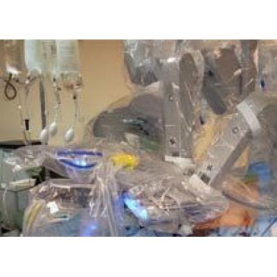 Впервые в Израиле:В Медицинском Центре «Шеба» с помощью робота Да Винчи через единственное отверстие в пупке удалена опухольсигмовидной кишки
