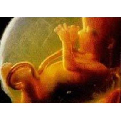 Омичка сама сделала себе аборт на 8-м месяце беременности