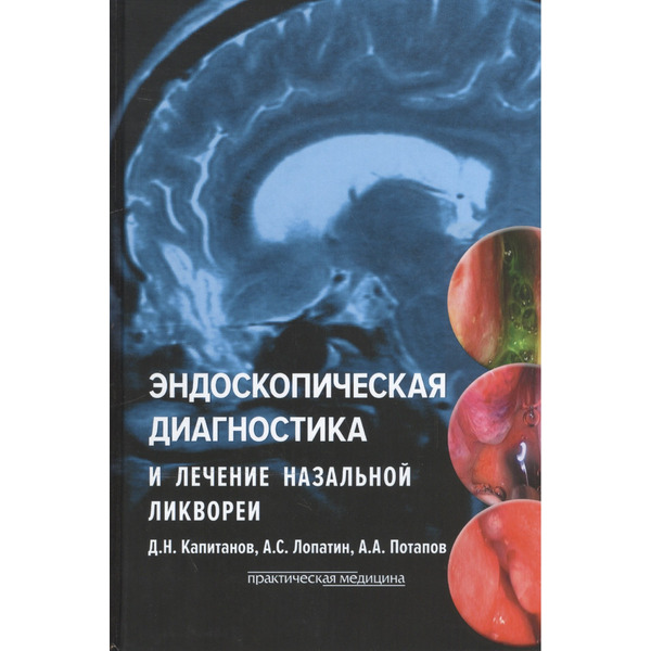 Эндоскопическая диагностика и лечение назальной ликвореи