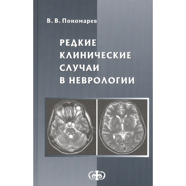 Редкие клинические случаи в неврологии. Руководство для врачей