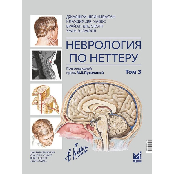 Неврология по Неттеру: В 3-х томах. Том 3