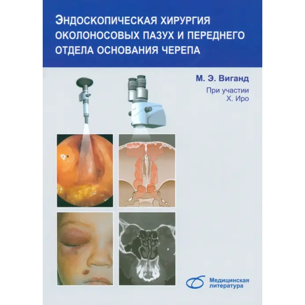 Эндоскопическая хирургия околоносовых пазух и переднего отдела основания черепа