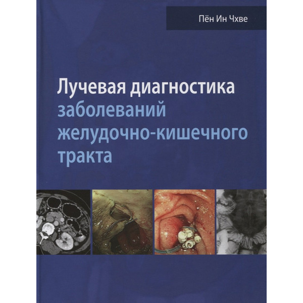 Лучевая диагностика заболеваний желудочно-кишечного тракта