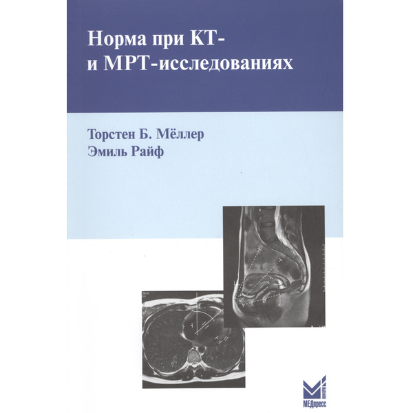 Норма при КТ - и МРТ - исследованиях