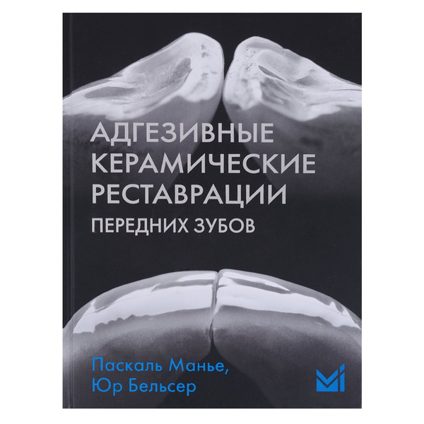Адгезивные керамические реставрации передних зубов