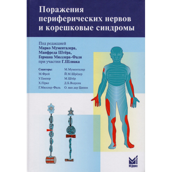 Поражение периферических нервов и корешковые синдромы