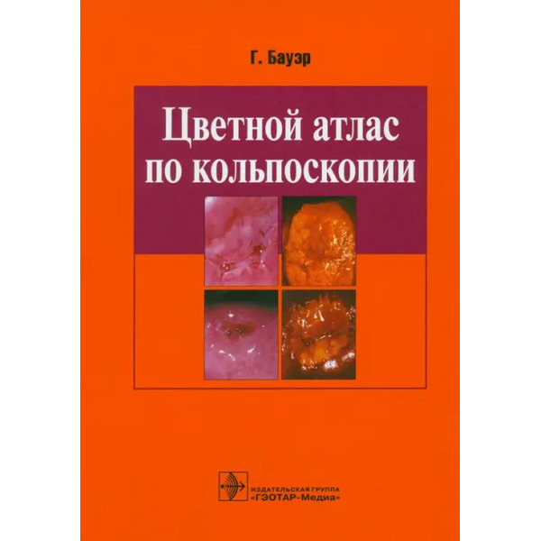 Цветной атлас по кольпоскопии