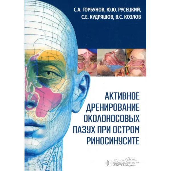 Активное дренирование околоносовых пазух при остром риносинусите